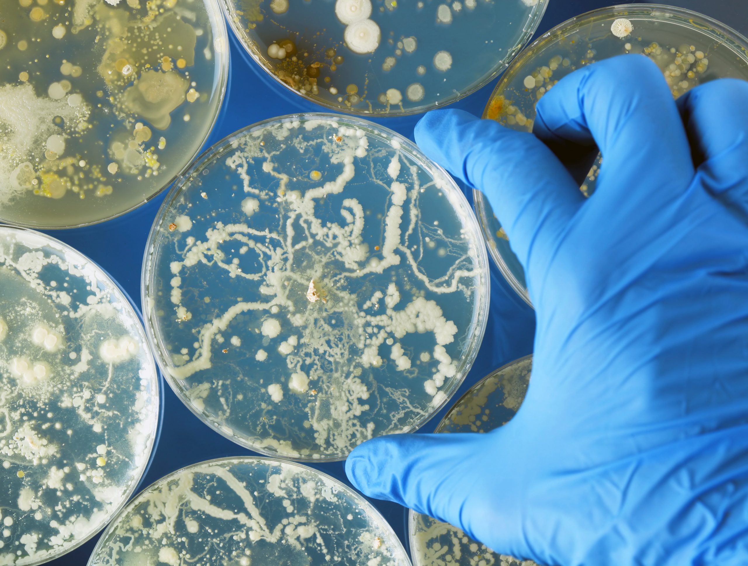 Cases Of Dangerous Drug Resistant Fungal Infections Are Spreading